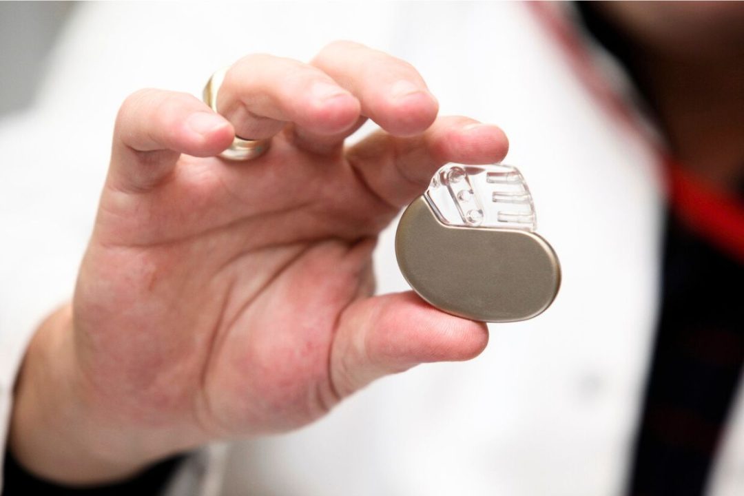 Une Volvo recharge par erreur le pacemaker d’un patient